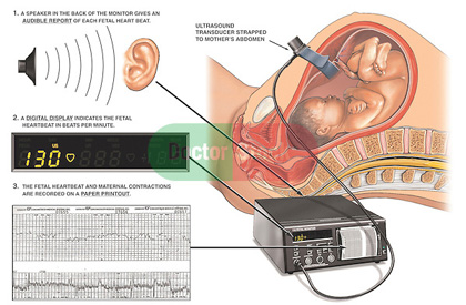 electronic fetal monitor