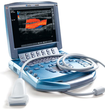 portable ultrasound system